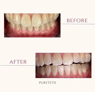 ホワイトニングサロンPURETETH所属・ホワイトニングサロン PURETETHのエステ・リラクイメージ