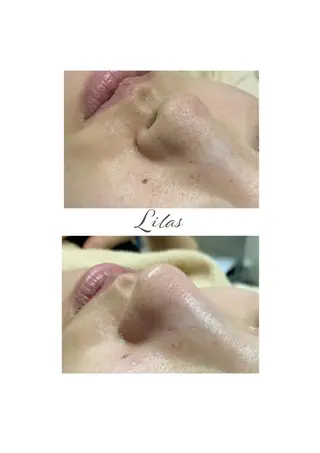 Lilas 【リラ】 小野かづさのエステ・リラクイメージ