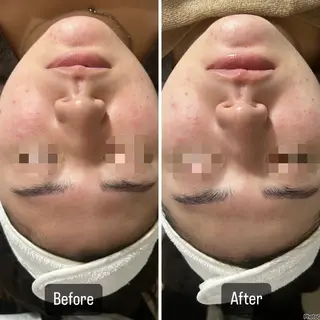 脱毛＆Beauty salon IILA所属・肌管理/HBL専門店 Sakuraの眉毛・アイブロウイメージ