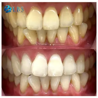 LBSホワイトニング 銀座店💎スタッフ峯のその他イメージ