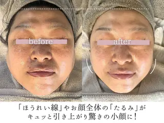 頭蓋骨小顔コルギPerm所属・頭蓋骨小顔コルギ Permのその他イメージ