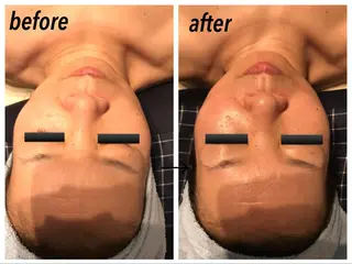 フェアリーローズ所属・fairyrose organicエステのエステ・リラクイメージ