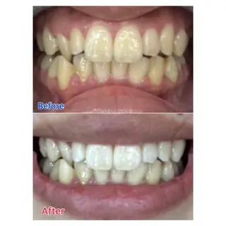 MBEAUTYSALON 千葉店・京成大久保所属・Melty 輝のその他イメージ