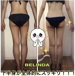 BELINDA銀座店 ✨痩身エステサロン✨のエステ・リラクイメージ