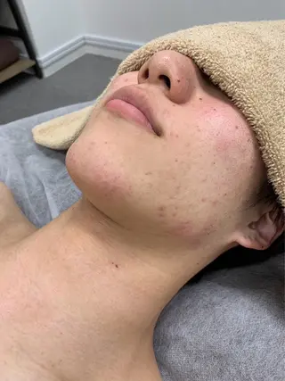 メンズ 脱毛サロン BRIDGE橋本のエステ・リラクイメージ