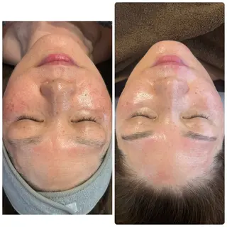 Beauty salon 705のエステ・リラクイメージ