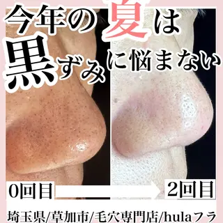 毛穴専門店hula 杉山智美のエステ・リラクイメージ