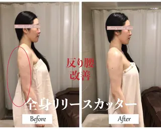 肩こり改善 筋膜リリースカッターのエステ・リラクイメージ