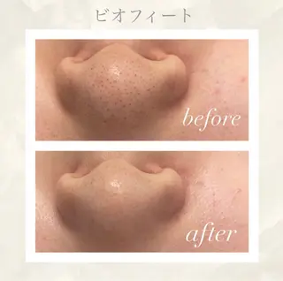 🦋美肌サロン. maho🦋のエステ・リラクイメージ