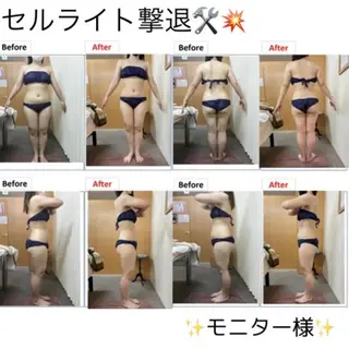 トータル美容 RAYVIS札幌店のエステ・リラクイメージ