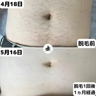 メンズ Beauty Salon MARU所属・新潟市メンズ【脱毛】 MARUのエステ・リラクイメージ