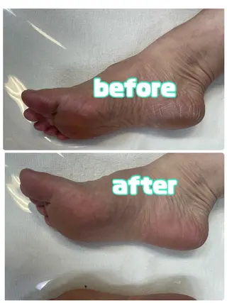 メンズ キッズ 肌質改善・脱毛サロン Luangeのエステ・リラクイメージ