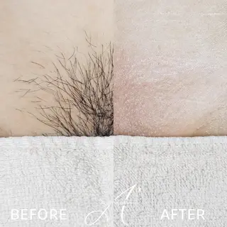 A*[エースター] シュガーリング🍋のエステ・リラクイメージ