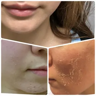 FLEUR大阪・美容 整体・痩身・小顔のエステ・リラクイメージ