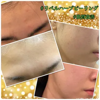 【リベルハーブピーリング認定店】敏感肌・美白脱毛専門店Dione立川店所属・Dione 立川店のエステ・リラクイメージ
