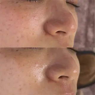 肌育×小顔×毛穴洗浄 ただののエステ・リラクイメージ