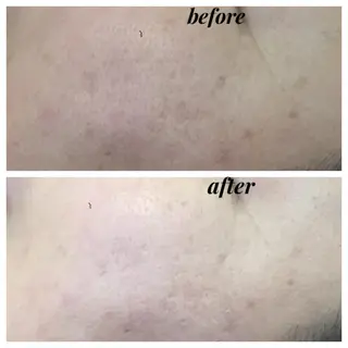 痩身専門サロン ビューティーグランツのエステ・リラクイメージ