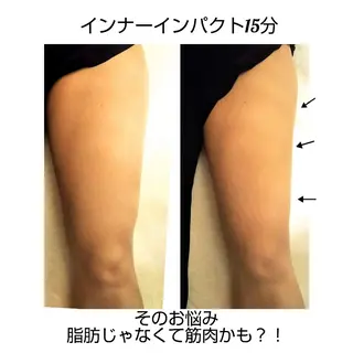 【ニキビ/肌管理】 salon varyのエステ・リラクイメージ