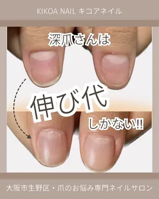ネイル KIKOA NAIL キコアネイルのネイルデザイン