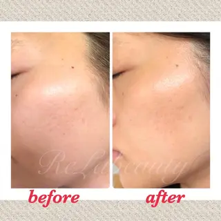 美ola ビオラのエステ・リラクイメージ