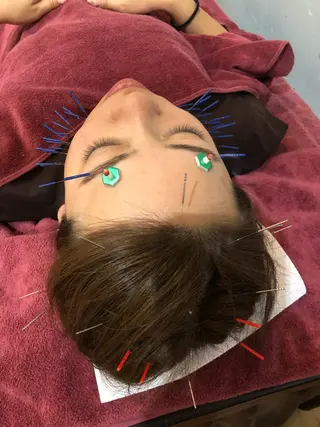 美容鍼灸女性専用 りんご鍼灸治療院のその他イメージ