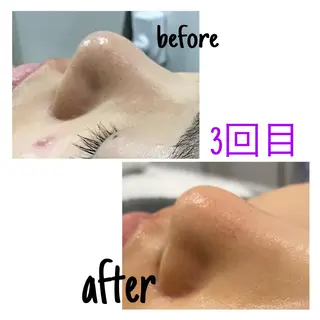 アルカンジュ~archange~所属・痩身/毛穴洗浄/脱毛 アルカンジュのエステ・リラクイメージ