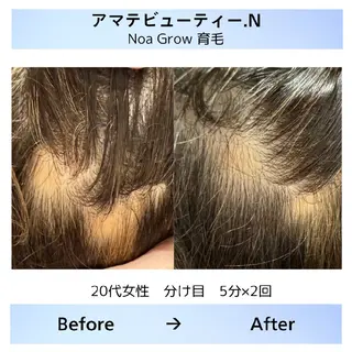 メンズ 痩身小顔専門 アマテ ビューティー.Nのエステ・リラクイメージ