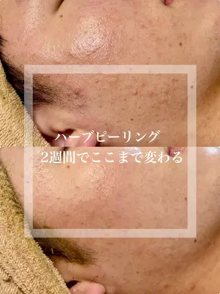 WHITE AQUA 北千住店のエステ・リラクイメージ