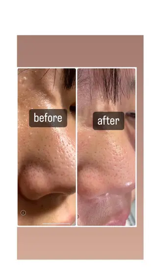 脱毛・エステサロン LuLuNのエステ・リラクイメージ