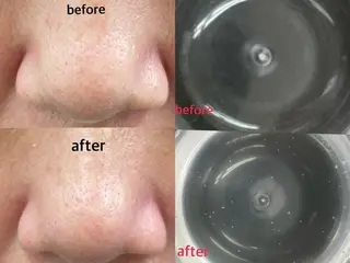 肌ケア＆毛穴洗浄 Cheriのエステ・リラクイメージ