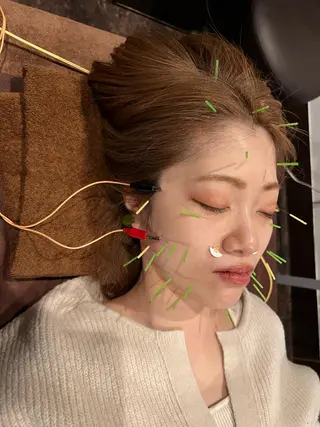 メンズ 美容鍼灸サロン LOMIHARIのエステ・リラクイメージ