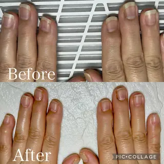 ネイル 深爪・自爪育成専門 MAHALOHIのネイルデザイン