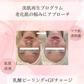 beauty SalonRcoinのマツエク・マツパデザイン