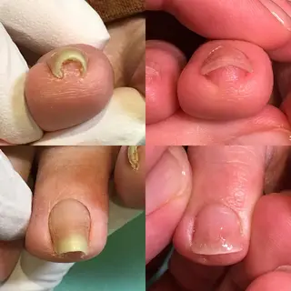 ネイル 東京巻き爪アカデミー所属・東京巻き爪 アカデミーのエステ・リラクイメージ