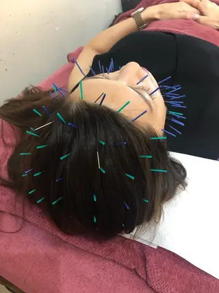 美容鍼灸女性専用 りんご鍼灸治療院のその他イメージ