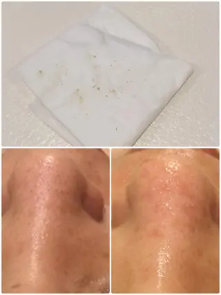 【リベルハーブピーリング認定店】敏感肌・美白脱毛専門店Dione立川店所属・Dione 立川店のエステ・リラクイメージ