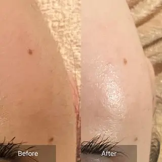 Mandarin Orange所属・毛穴から始める肌メン テマンダリンオレンジのエステ・リラクイメージ