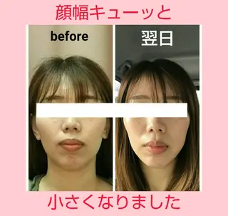 小顔と美肌 まごころエステMatoria所属・小顔 美肌専門 Matoriaのエステ・リラクイメージ