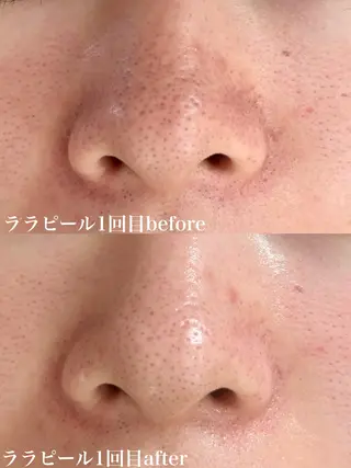 WHITE AQUA 北千住店のエステ・リラクイメージ