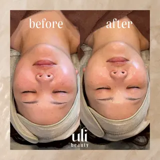uli beauty所属・韓国肌管理サロン ulibeautyのエステ・リラクイメージ