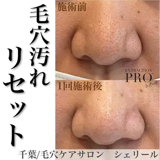 シェリール✳︎ Erinaのマツエク・マツパデザイン