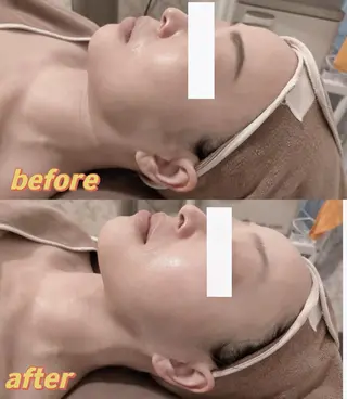 西区九条エステ MITUREIサロンのエステ・リラクイメージ