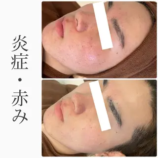 ハーブピーリング専門 BIOEL横浜のエステ・リラクイメージ