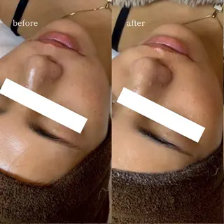 EARNEST大阪 心斎橋【韓国肌管理】のエステ・リラクイメージ