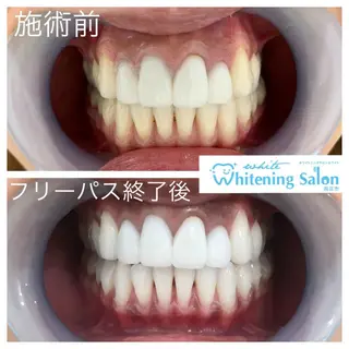 ホワイトニング&アイラッシュ四日市ホワイト所属・アイラッシュ ホワイトニング四日市のマツエク・マツパデザイン