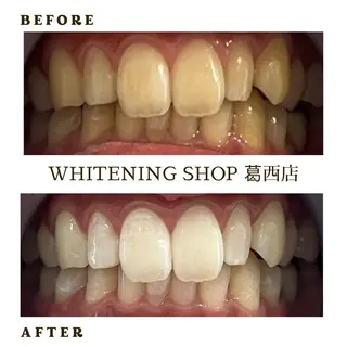 メンズ ホワイトニング ショップ葛西店のその他イメージ