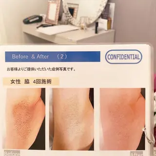 💎Jemery 脱毛まつエクサロン💎所属・Jemery関内/ 眉毛/まつ毛/脱毛の眉毛・アイブロウイメージ