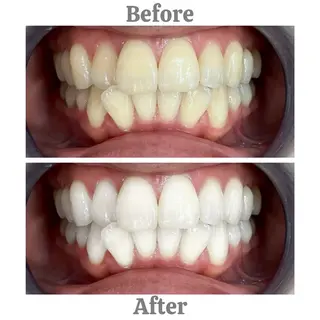 セルフホワイトニング　エクシア相模大野店所属・セルフホワイトニング エクシア相模大野店のその他イメージ