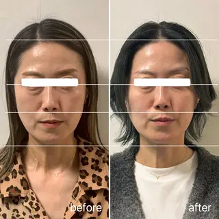 スキンケアサロン　デディア所属・米谷🎀 デディア恵比寿🪞✨のエステ・リラクイメージ