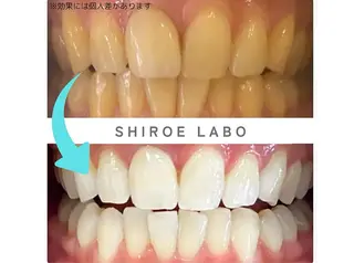【歯のホワイトニング専門店】シロエラボ梅田店所属・シロエラボ 梅田店のその他イメージ
